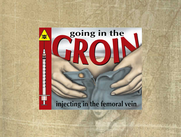 Going in the Groin 2001