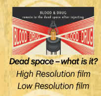 Dead space - what is it?